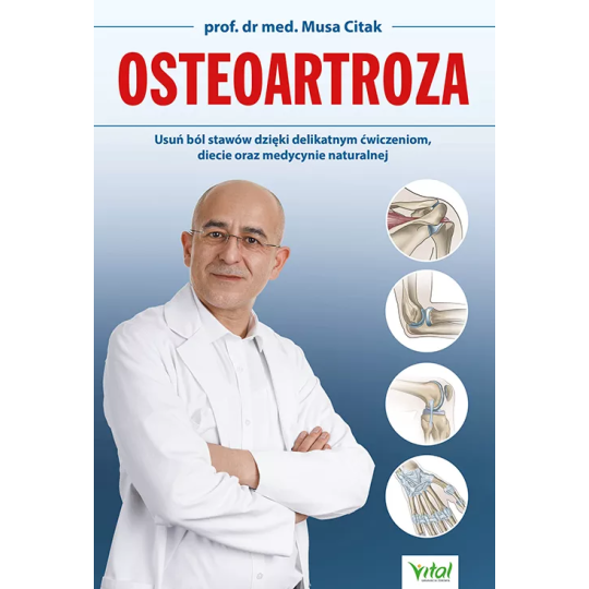 Osteoartroza - Musa Citak - 7016