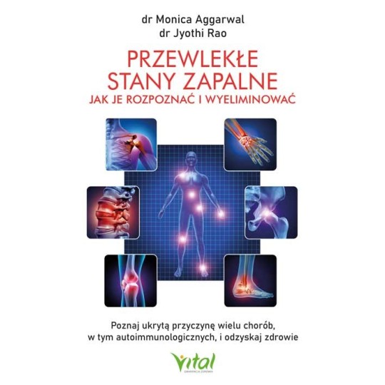 Przewlekłe stany zapalne – jak je rozpoznać i wyeliminować - Jyothi Rao, Monica Aggarwal - 7168