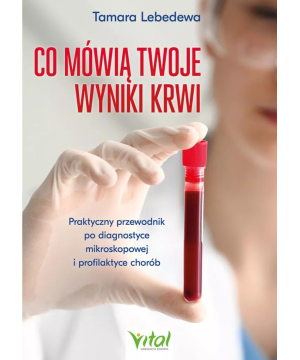 Co mówią twoje wyniki krwi...