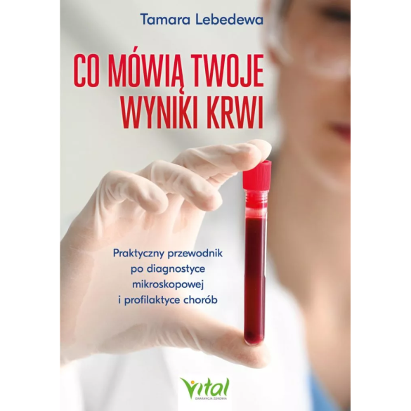 Co mówią twoje wyniki krwi - Tamara Lebedewa