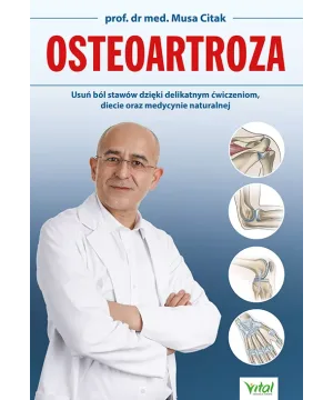 Osteoartroza - Musa Citak