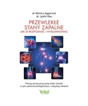 Przewlekłe stany zapalne – jak je rozpoznać i wyeliminować - Jyothi Rao, Monica Aggarwal