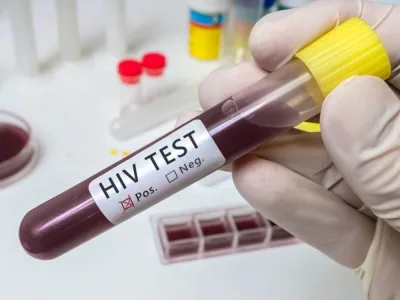 Zakażenia HIV i AIDS