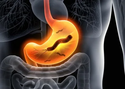 Helicobacter pylori – przebiegła bakteria