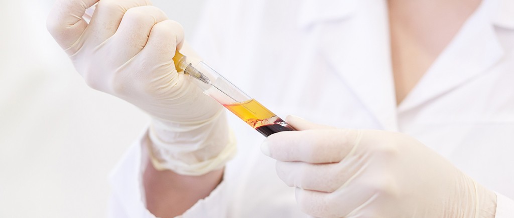 Nowoczesne zabiegi – synergia nauki i natury – osocze bogatopłytkowe