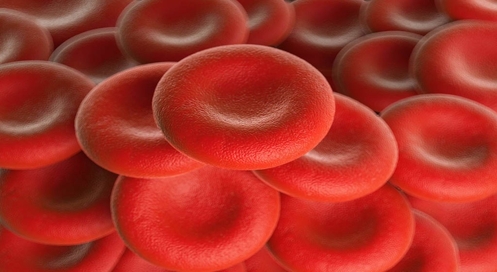 Choroba Buergera – zakrzepowo-zarostowe zapalenie naczyń