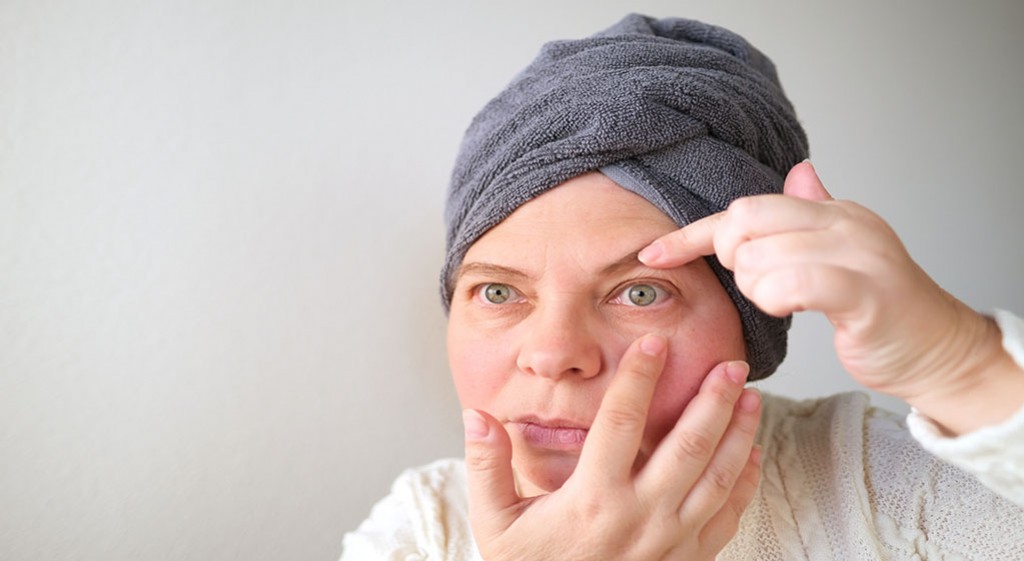 Problem opadających powiek