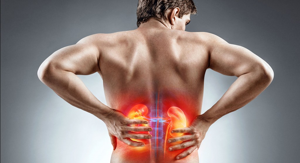 Co wywołuje kamicę nerkową