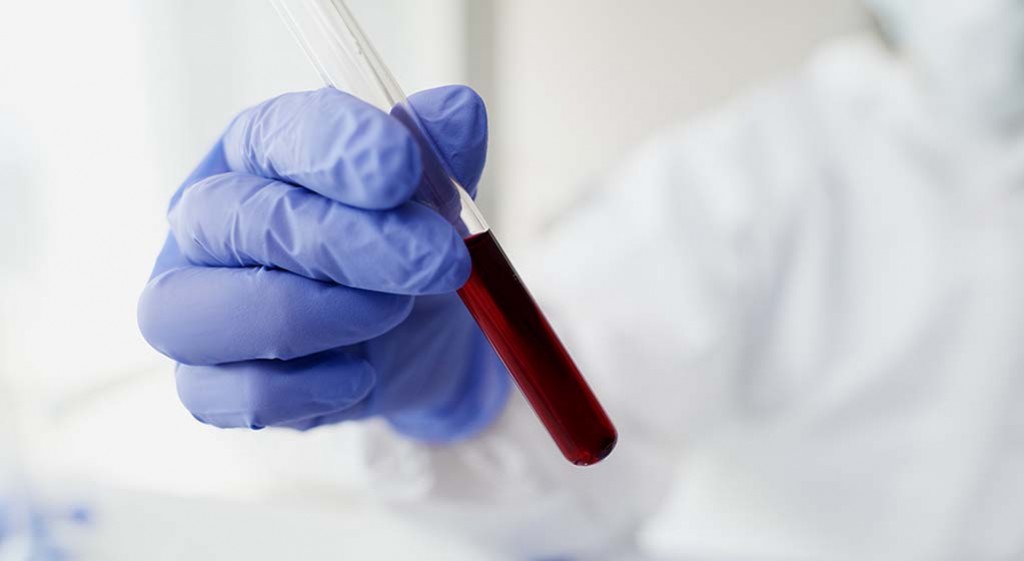 Jak interpretować wyniki morfologii krwi