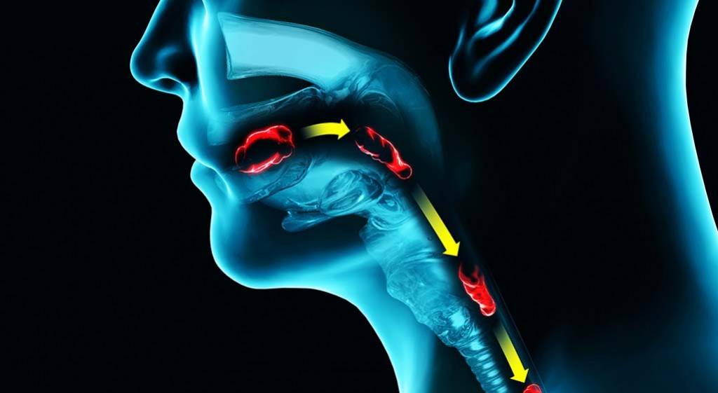 Dysfagia – zaburzenia połykania