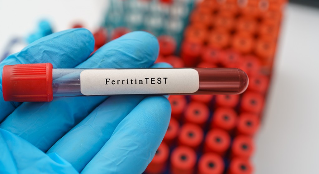 Ferrytyna – magazyn żelaza