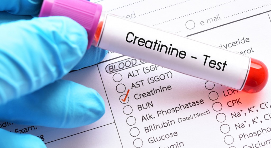 Kreatynina – marker sprawności nerek