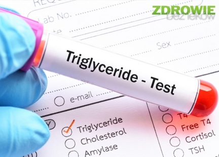 Badajmy poziom trójglicerydów we krwi