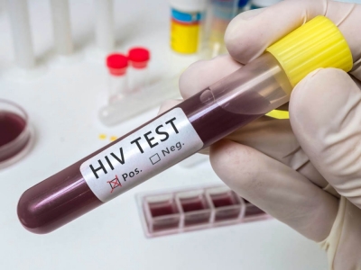 Zakażenia HIV i AIDS