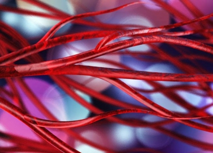 Zwężenie tętnic szyjnych