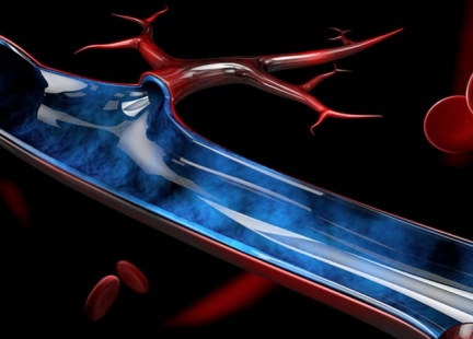 Choroby tętnic kończyn górnych