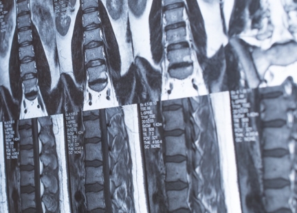 Budowa i funkcje krążka międzykręgowego (dysku)