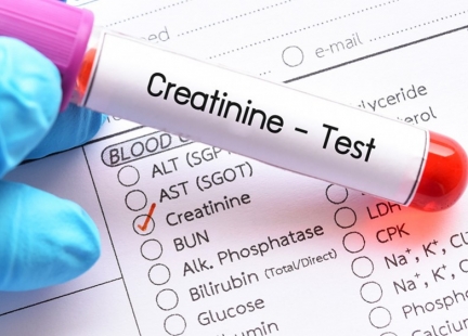 Kreatynina – marker sprawności nerek